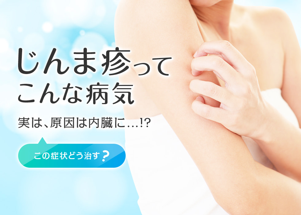 じんま疹ってこんな病気 実は、原因は内臓に...!? この症状どう治す？